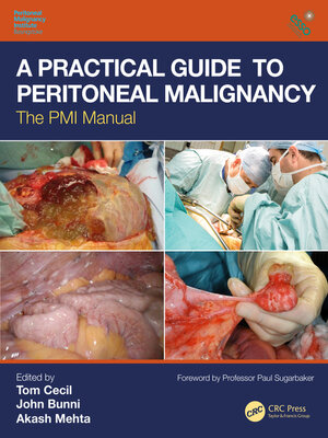 cover image of A Practical Guide to Peritoneal Malignancy